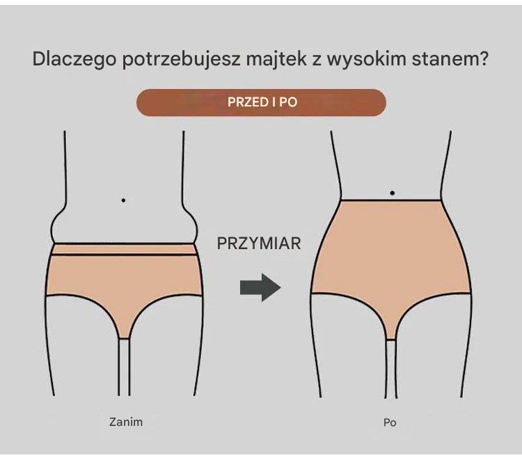 🩲🔥50% zniżki! 【6 sztuk】Damskie bikini z wysokim stanem z jedwabiu lodowego, duże rozmiary, wysoka elastyczność 【45 kg-135 kg】