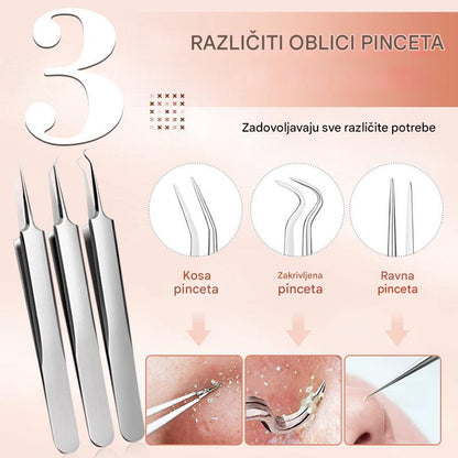 💓Najprodavaniji💥Set medicinskih pinceta za mitesere